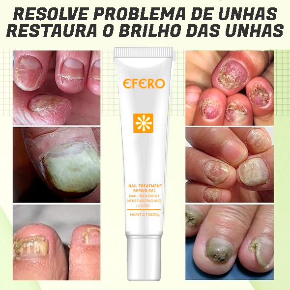 Fungus Remover - Gel Antifúngico instatanêo