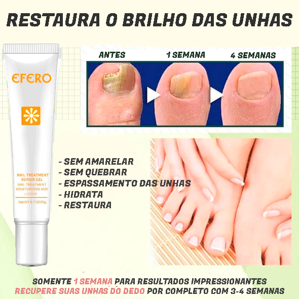 Fungus Remover - Gel Antifúngico instatanêo